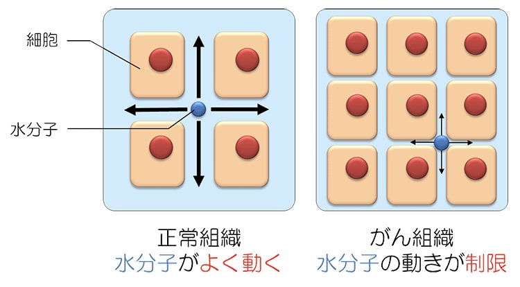 DWIBSで何がわかるの？
